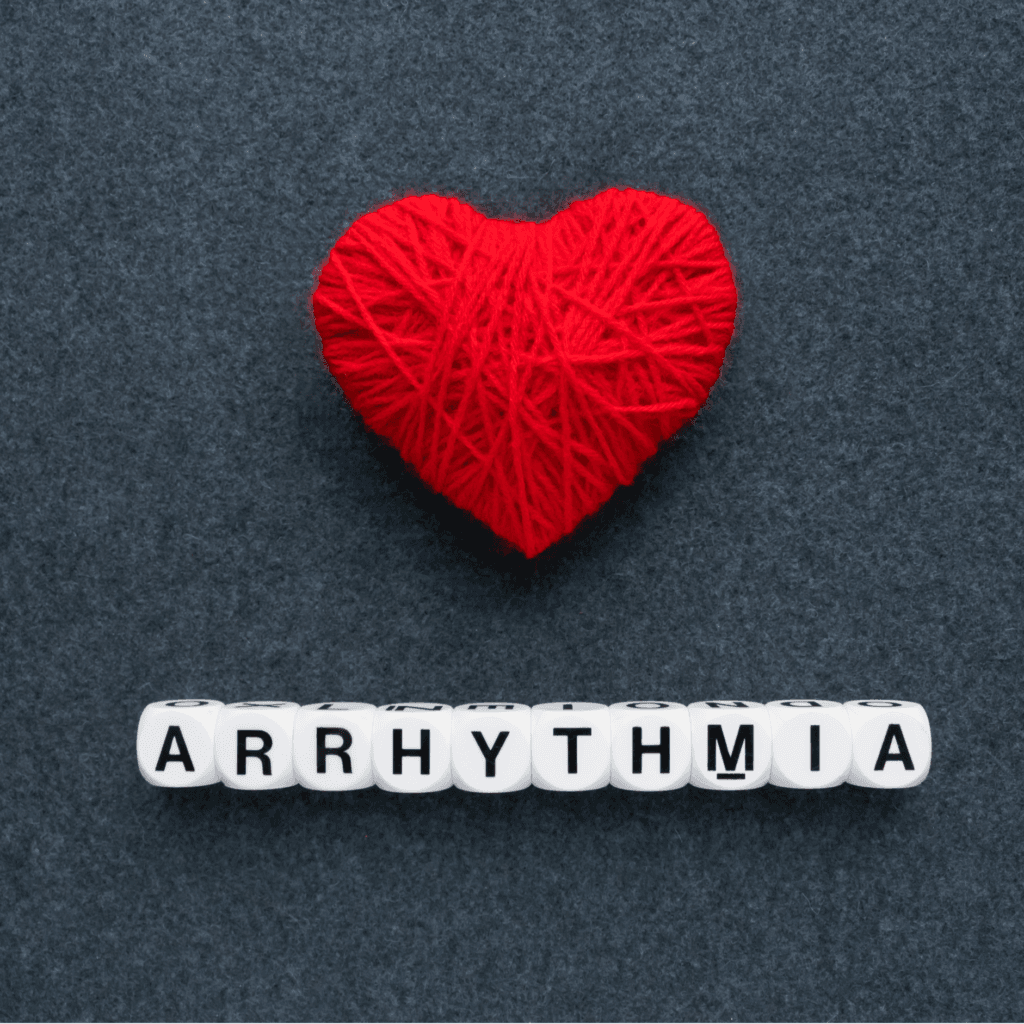Arrhythmia & Lifestyle Modifications Guide to Reduce Your Risk
